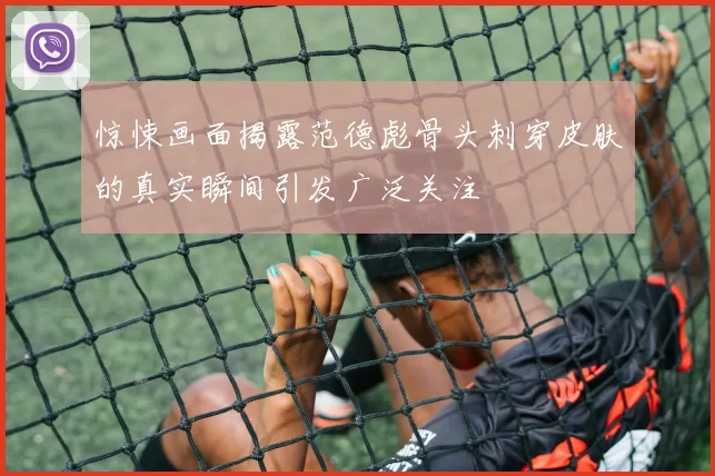 惊悚画面揭露范德彪骨头刺穿皮肤的真实瞬间引发广泛关注